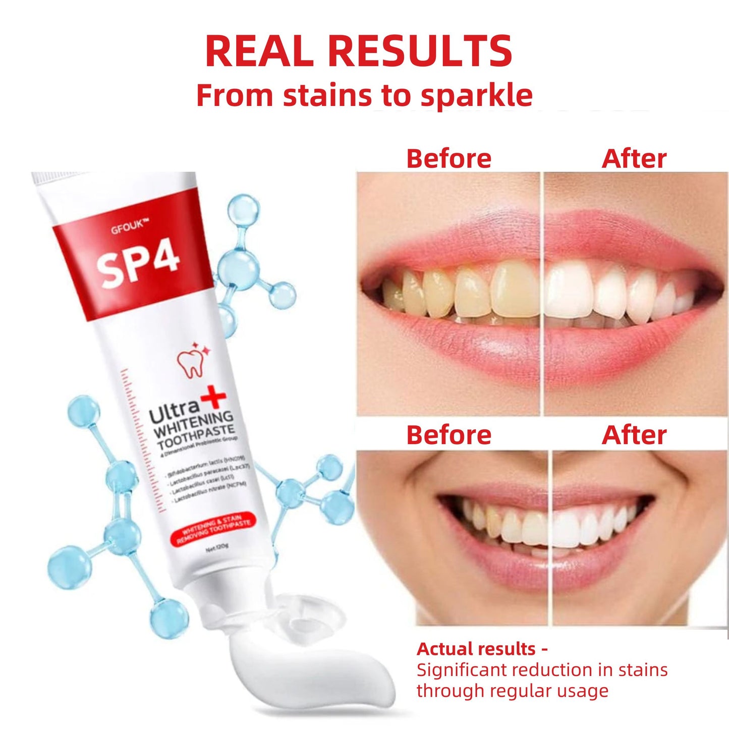 Original™ SP-4 Ultra+ Whitening Toothpaste (Buy 1 Get 1 Free)
